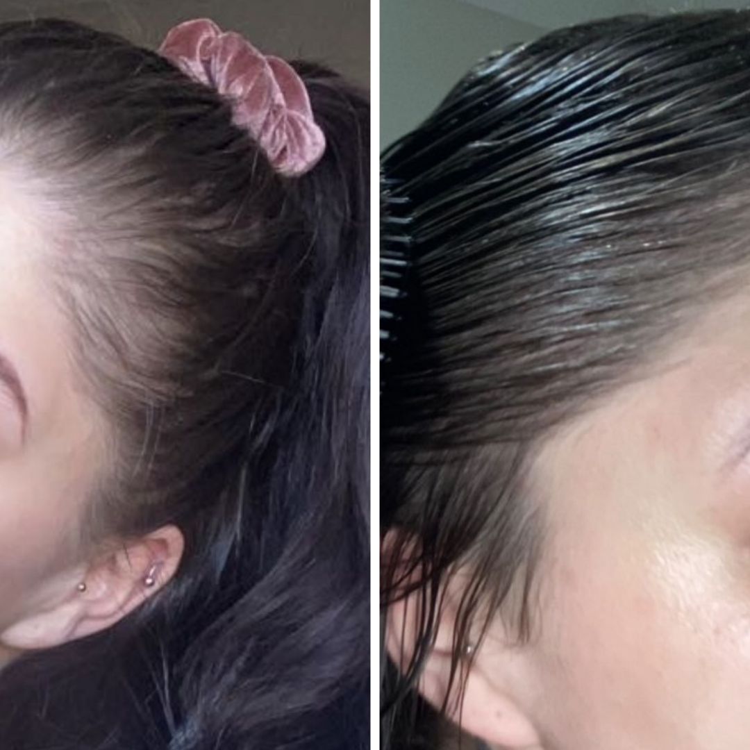 The Magic Hair Growth Serum with Derma-Roller Applicator