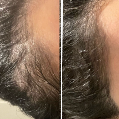 The Magic Hair Oil