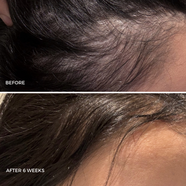The Magic Hair Growth Serum with Micro-infusion Applicator